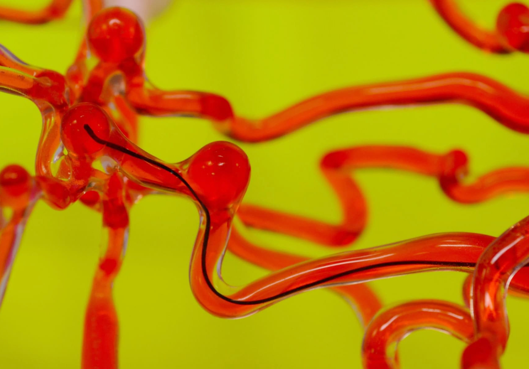 Robot “sợi chỉ” giúp chữa bệnh đột quỵ

